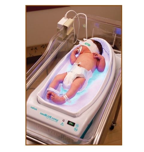 Yenidoğan bebek fototerapi mavi ışık sarılık tedavisi